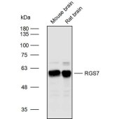 Solarbio K110060P Anti-RGS7 Polyclonal Antibody