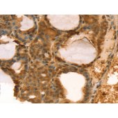 Solarbio K009807P Anti-TAF11 Polyclonal Antibody