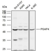 Solarbio K110039P Anti-PGAP4 Polyclonal Antibody