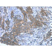 Solarbio K009803P Anti-SCPEP1 Polyclonal Antibody