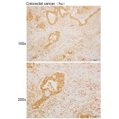 Solarbio K110011P Anti-SNX8 Polyclonal Antibody