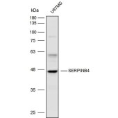 Solarbio K110318P Anti-SERPINB4 Polyclonal Antibody
