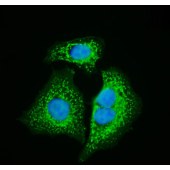 Solarbio K009460P Anti-HSPD1 Polyclonal Antibody