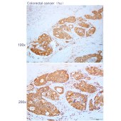 Solarbio K112243P Anti-SEC11A Polyclonal Antibody