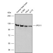 Solarbio K009845P Anti-IPO11 Polyclonal Antibody