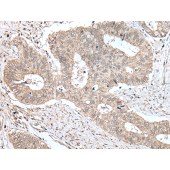 Solarbio K009820P Anti-ZNF131 Polyclonal Antibody