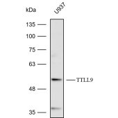 Solarbio K112418P Anti-TTLL9 Polyclonal Antibody