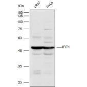 Solarbio K110388P Anti-IFIT1 Polyclonal Antibody