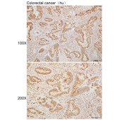 Solarbio K110297P Anti-YWHAE Polyclonal Antibody