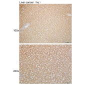 Solarbio K110066P Anti-RHOT2 Polyclonal Antibody