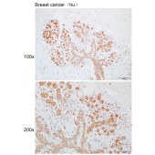 Solarbio K110283P Anti-ARRB2 Polyclonal Antibody