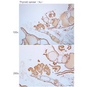Solarbio K112304P Anti-GFOD2 Polyclonal Antibody