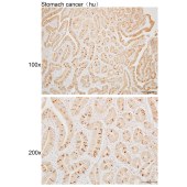 Solarbio K110004P Anti-GALM Polyclonal Antibody