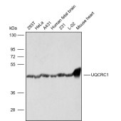 Solarbio K009810P Anti-UQCRC1 Polyclonal Antibody