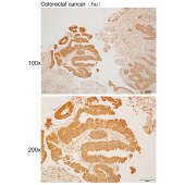 Solarbio K110472P Anti-TENT5A Polyclonal Antibody