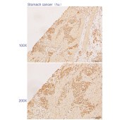Solarbio K110471P Anti-NOLC1 Polyclonal Antibody