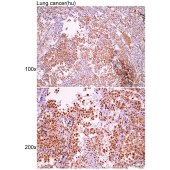 Solarbio K007507P Anti-HDAC1 Polyclonal Antibody