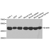 Solarbio K006153P Anti-β-actin Polyclonal Antibody