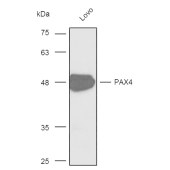 Solarbio K003982P Anti-PAX4 Rabbit Polyclonal Antibody