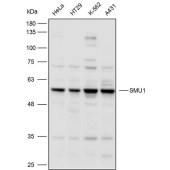 Solarbio K110359P Anti-SMU1 Polyclonal Antibody