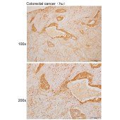 Solarbio K109996P Anti-PREB Polyclonal Antibody