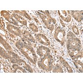 Solarbio K009812P Anti-TBCA Polyclonal Antibody