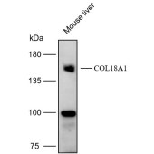 Solarbio K112175P Anti-COL18A1 Polyclonal Antibody