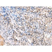Solarbio K009899P Anti-AAK1 Polyclonal Antibody