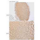 Solarbio K110508P Anti-TGFBR2 Polyclonal Antibody