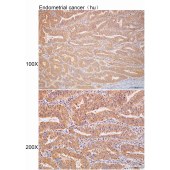 Solarbio K112210P Anti-CLASP1 Polyclonal Antibody