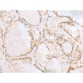 Solarbio K009843P Anti-RABGGTA Polyclonal Antibody