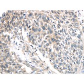 Solarbio K009878P Anti-IQGAP2 Polyclonal Antibody