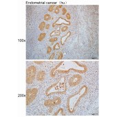 Solarbio K110090P Anti-RNF220 Polyclonal Antibody