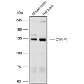 Solarbio K110117P Anti-CYFIP1 Polyclonal Antibody
