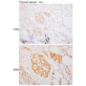 Solarbio K110395P Anti-NCBP2 Polyclonal Antibody