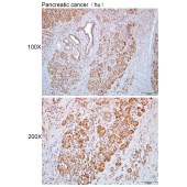 Solarbio K112422P Anti-TDRD3 Polyclonal Antibody