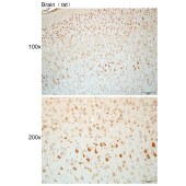 Solarbio K112423P Anti-SCGB1A1 Polyclonal Antibody