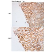 Solarbio K112237P Anti-ANKRD13A Polyclonal Antibody