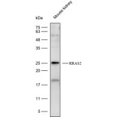 Solarbio K112420P Anti-RRAS2 Polyclonal Antibody
