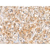 Solarbio K009856P Anti-RIDA Polyclonal Antibody