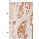 Solarbio K112167P Anti-PARD3 Polyclonal Antibody