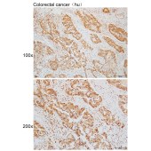 Solarbio K110057P Anti-OSGEP Polyclonal Antibody