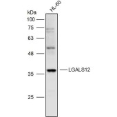 Solarbio K110061P Anti-LGALS12 Polyclonal Antibody