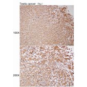 Solarbio K112184P Anti-GPRASP1 Polyclonal Antibody