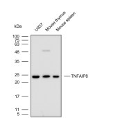 Solarbio K112255P Anti-TNFAIP8 Polyclonal Antibody