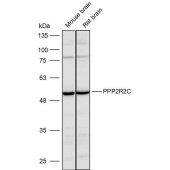 Solarbio K110124P Anti-PPP2R2C Polyclonal Antibody