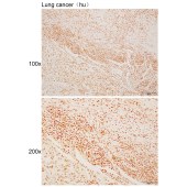 Solarbio K110517P Anti-SET Polyclonal Antibody