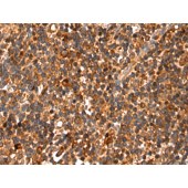 Solarbio K009874P Anti-TNXB Polyclonal Antibody