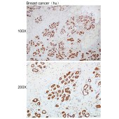 Solarbio K112236P Anti-TSPO Polyclonal Antibody