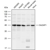 Solarbio K109938P Anti-DAZAP1 Polyclonal Antibody